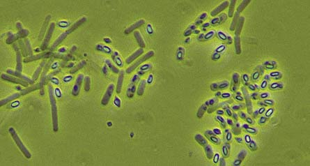 bacillus Controllo della processionaria